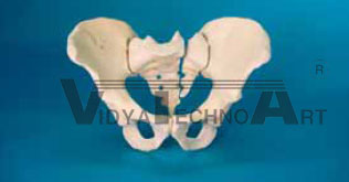 Pelvis complete, Sacrum fractured